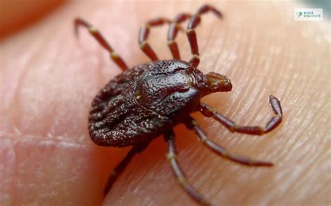 Lyme Disease Treatment Prevention Stages And Symptoms