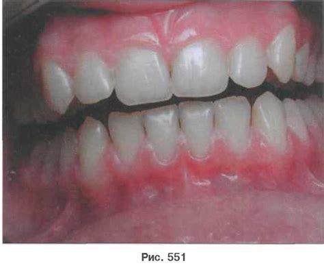 ГРУППА РЕЗЦОВ