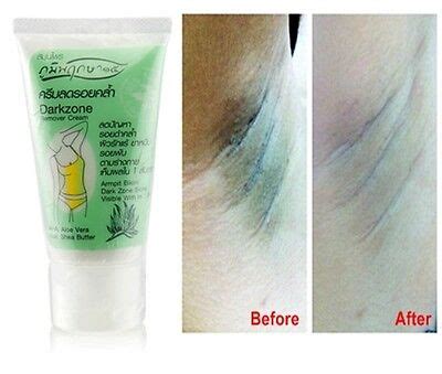 X UNDERARM ARMPIT BIKINI WHITENING NATURAL CREAM DARK SKIN REMOVE FAST RESULT EBay