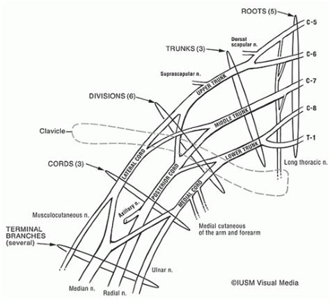 Neoplastic Brachial Plexopathy Neupsy Key