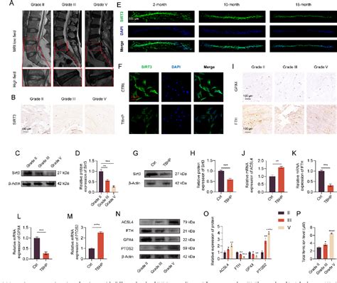 Figure 2 From The Deubiquitinase Usp11 Ameliorates Intervertebral Disc