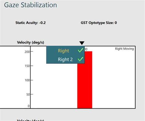 VisualEyes™ | Gaze Stabilization Test (GST) | Interacoustics