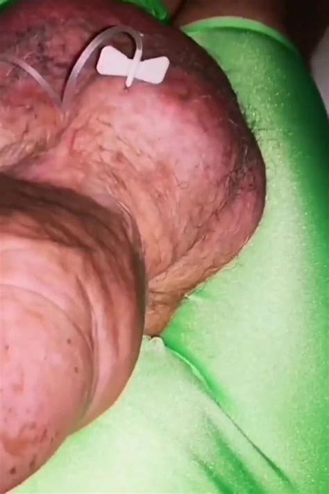 Another Extreme Filling Up With Glucose Gay Amateur Porn Feat Monster Meat By Faphouse Xhamster