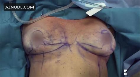 BOTCHED NUDE SCENES AZNude