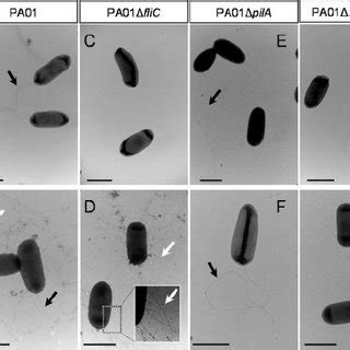 Transmission electron micrographs of representative cells... | Download ... 