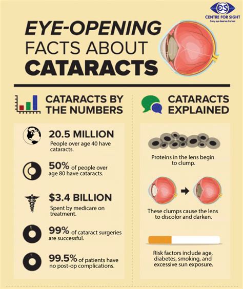 Eye Care Posters