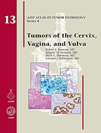 Tumors Of The Cervix Vagina And Vulva No 13 AFIP Atlas Of Tumor