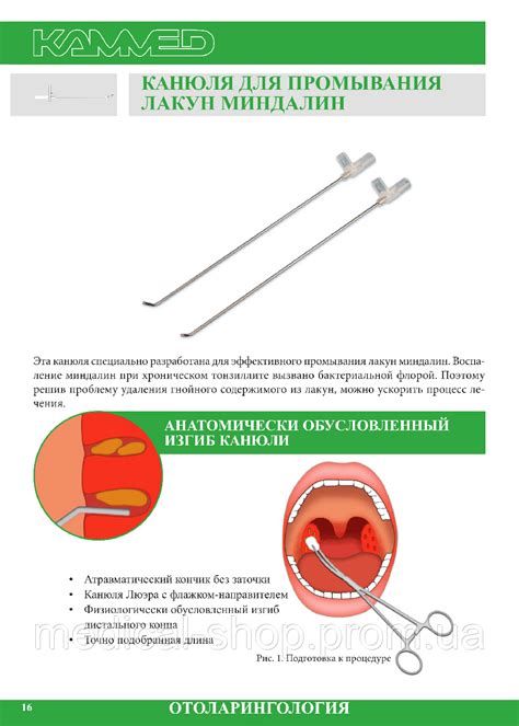 Канюля для промывания лакун миндалин, цена 47 грн - Prom.ua (ID#265164735)