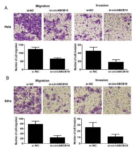 Circabcb Expression Promoted Tumor Migration And Invasion In Cervical