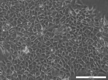 CMT 167 Cell Line Cell Lines Ximbio