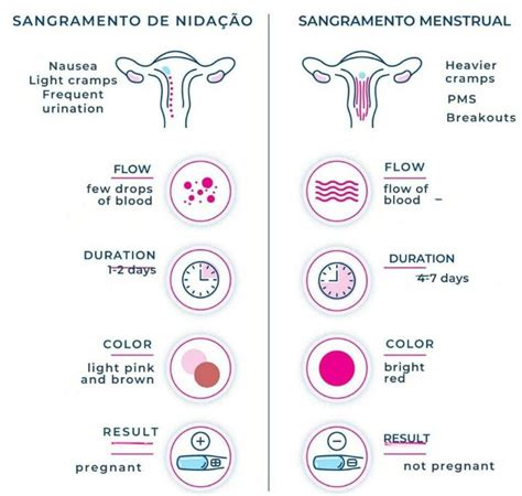 A Nidação Pode Ocorrer No Dia Da Menstruação - A Dor Nos Seios E O Sangue Da Nidação, Como São? – PCETSK