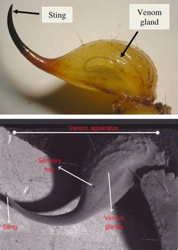 A Photomicrograph Showing The Morphology Of Venom Apparatus Of