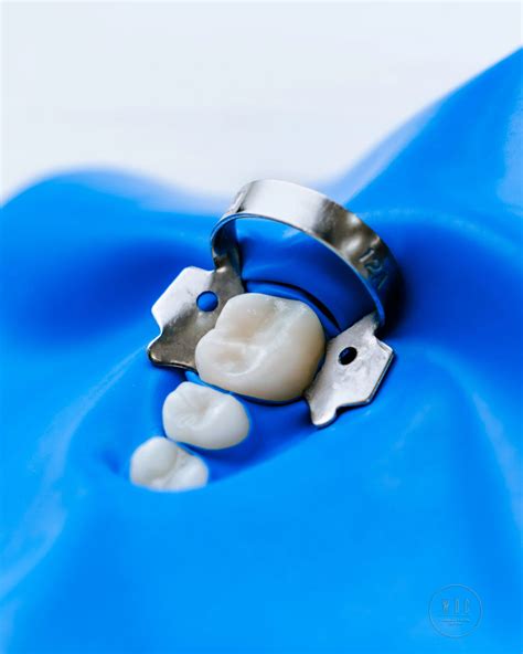 Rubber Dam in Dentistry: Precision, Comfort and Safety