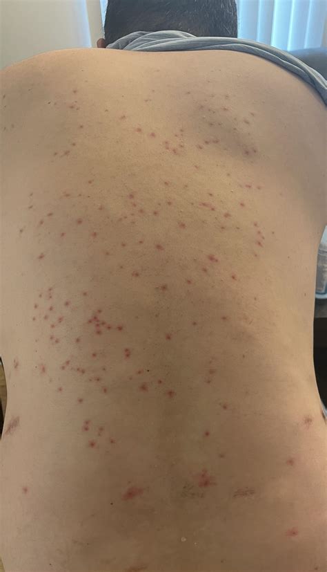 Best Surfing Naked Images On Pholder Real Girls Nsfw And