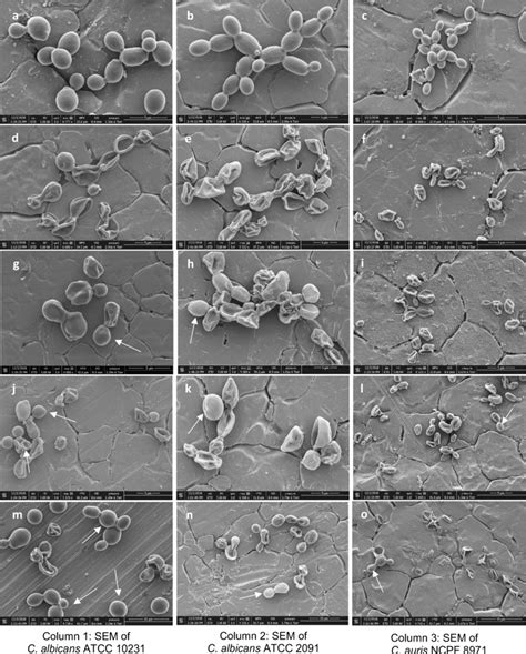 Scanning Electron Microphotographs Of C Albicans Atcc 10231 Column