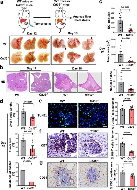 Cd Mediated Metabolic Crosstalk Between Tumor Cells And Macrophages