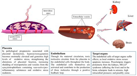 Ijms Free Full Text Oxidative Stress In Preeclampsia And Placental