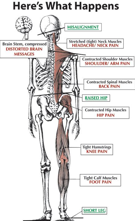 About Atlas Orthogonal Chiropractic — Atlas Orthogonal Chiropractic Dr Mark Van Doren D C