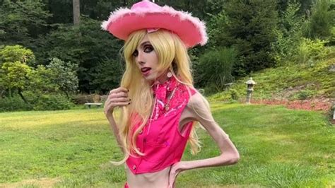 Anorexic Youtuber Eugenia Cooney 29 Sparks A Wave Of Concern Over Her