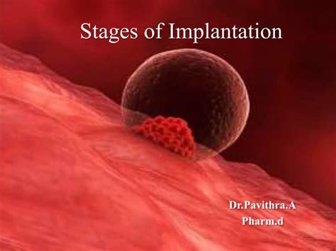stages  implantationpptx