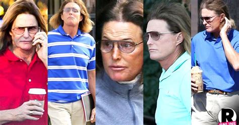 Doctor Tells All Bruce Jenners Sex Change Surgery From Preparations To Recovery In 9 Clicks