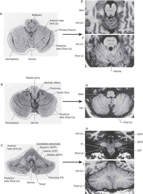 The Cerebellum Neupsy Key