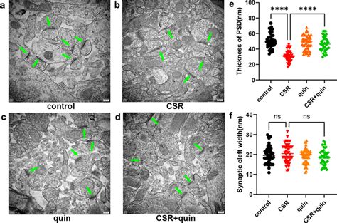 TEM evidence of rescued post-synaptic density by hippocampal delivery ...