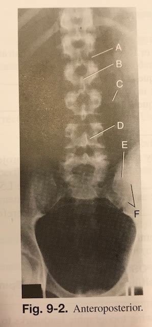 Ap L Spine Diagram Quizlet