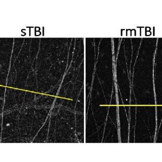 Microglial activation after sTBI and rmTBI in the retina. Microscope ...