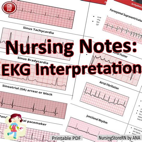 Nursing Notes Ekg Interpretation Made Easy Printable Pdf Etsy