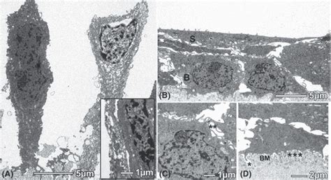 Transmission Electron Micrographs Demonstrating Human Corneal