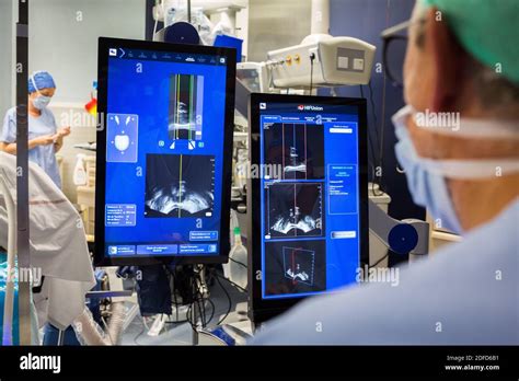 Treatment Of Prostatic Cancer By High Intensity Focus Ultrasound Focal