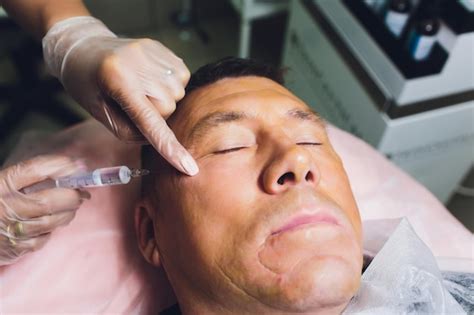 Primer plano del procedimiento para el lifting facial operación de