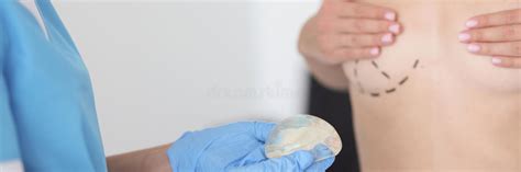 Plastic Surgeon Doctor Holding Breast Implant In Front Of Naked Female Patient With Preoperative