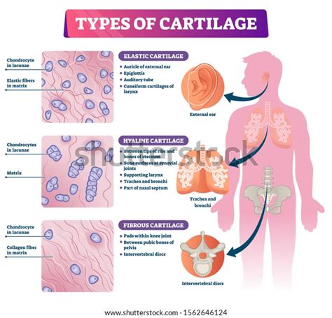 35,829 The Cartilage Images, Stock Photos & Vectors | Shutterstock