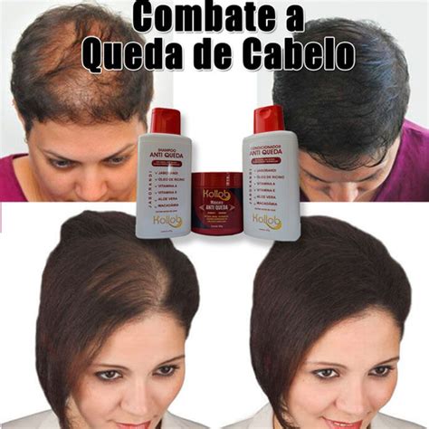 Kit Anti Queda Produtos Para Queda De Cabelo Feminino Mercado Livre