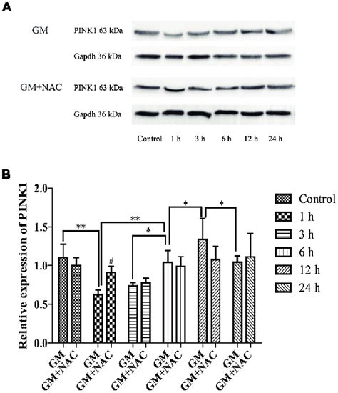 The Expression Of Phosphatase And Tensin Homolog Pten Induced