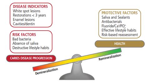 Risk Based Treatment Planning Decisions In Dentistry