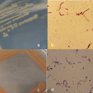 Macroscopic And Microscopic Characteristics From Bacteria Found In