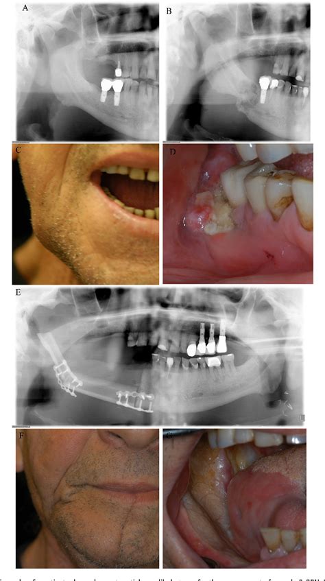 Pdf The Prevalence And Risk Factors Associated With