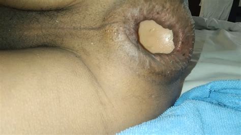 Anal Weit Offen Xhamster