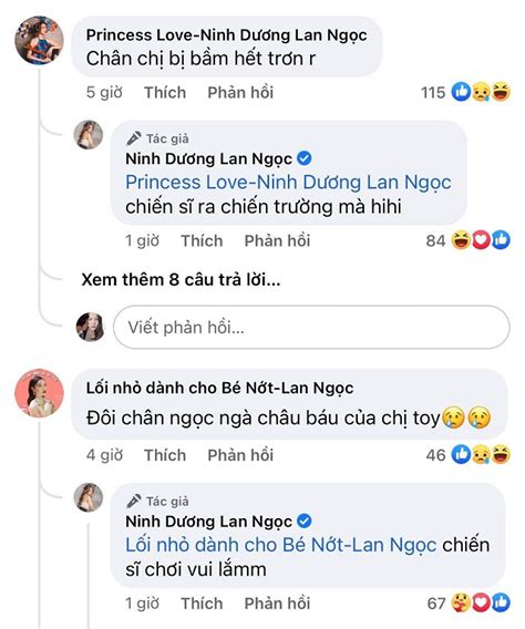 Ninh Dương Lan Ngọc diện bikini khoe thân hình bốc lửa vô tình để lộ đôi chân chằng chịt vết