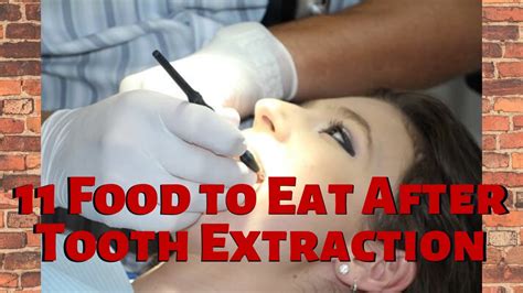 What To Eat After A Tooth Extraction A Guide To Soft And Soothing