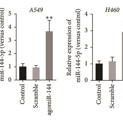 MiR 144 5p Expression In Lung Cancer Patient Samples And Cell Lines