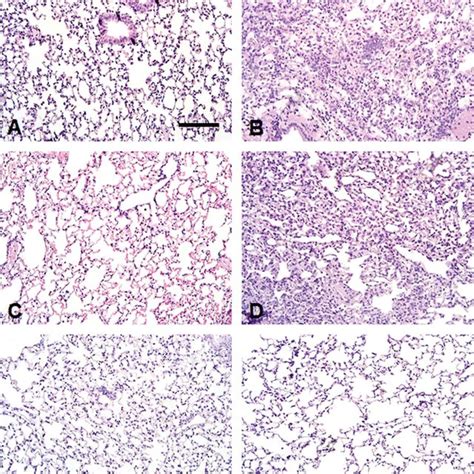 Photomicrographs Of Lung Sections Stained With Hematoxylin And Eosin