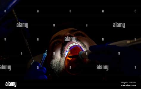 Tooth Decay Prevention Man In The Dentist Chair During A Dental