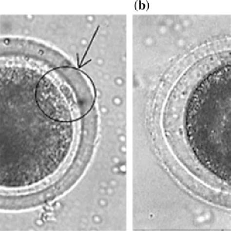 Denuded Oocytes With First Polar Body Considered As Mature Oocytes