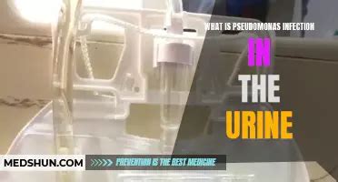 Urine Esbl Infections: Causes, Symptoms, And Treatments | MedShun