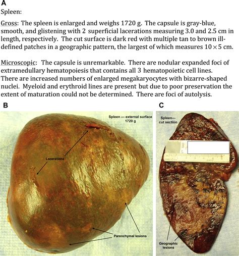Informatics and Autopsy Pathology - Surgical Pathology Clinics