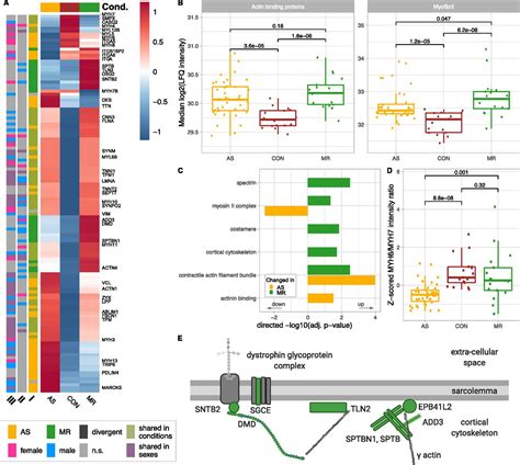 Disease And Sex Specific Differences In Patients With Heart Valve